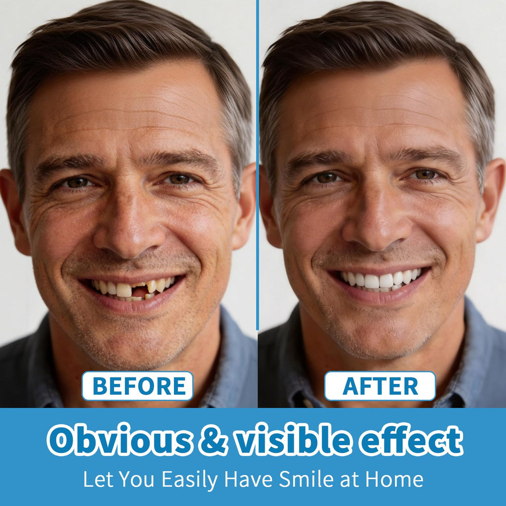 Silicone Denture Set Upper Lower Full Teeth W286953