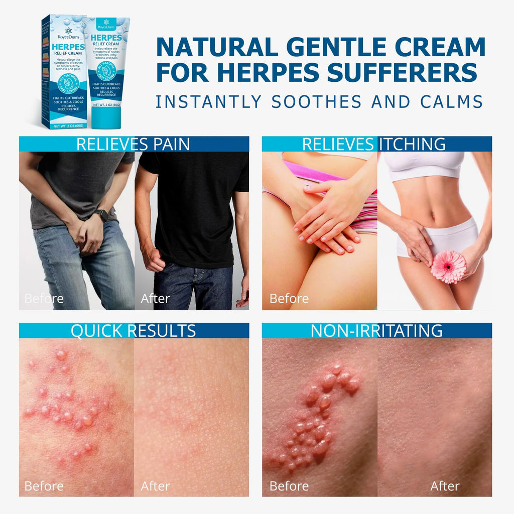 Herpes Cream S193033