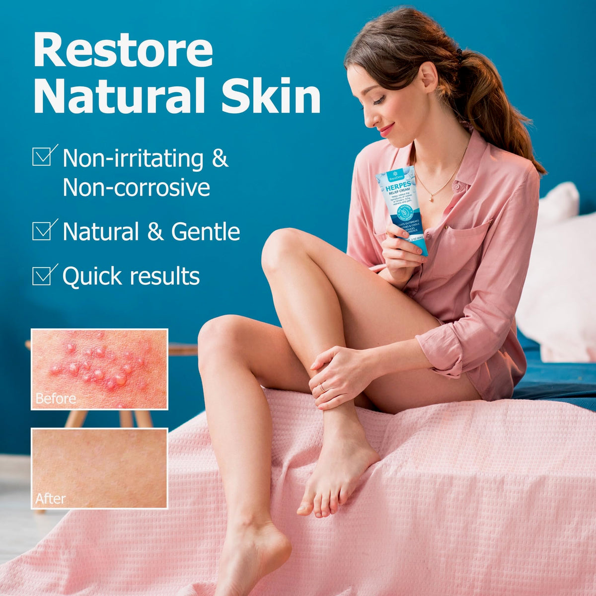 Herpes Cream S193033